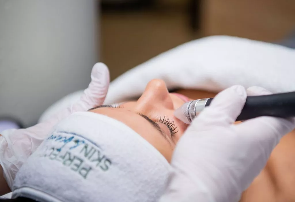 perfect-skin-beauty-huidverbetering-huissen-Microskinpolish-Huidverbetering_